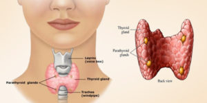 Hashimoto's disease, hypothyroidism